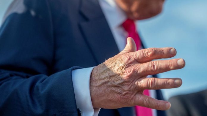 Tutupi Memar Pakai Makeup, Trump Mau Sembunyikan Penyakit?