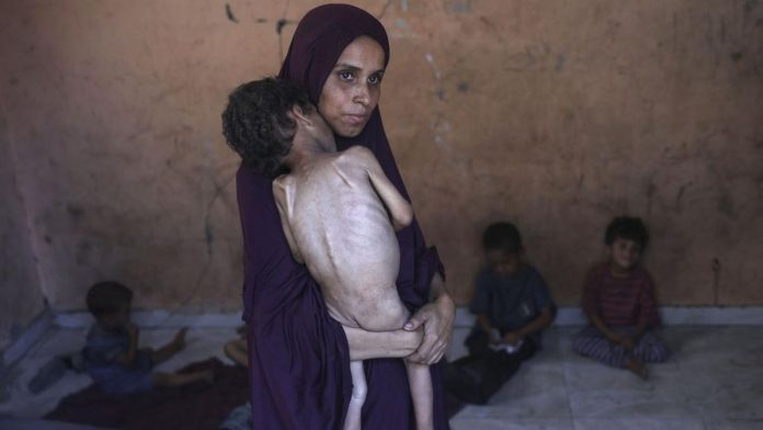 Bertambah Lagi Korban Tewas Akibat Kelaparan di Gaza